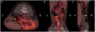 An evaluation of the physiological uptake range of 18F-fluoro-2-deoxy-D-glucose in normal ovaries of seven dogs using positron emission tomography/computed tomography